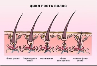 kw52sxzn